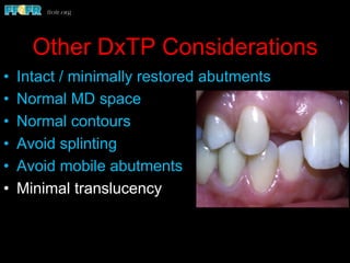 Other DxTP Considerations
•  Intact / minimally restored abutments
•  Normal MD space
•  Normal contours
•  Avoid splinting
•  Avoid mobile abutments
•  Minimal translucency
 