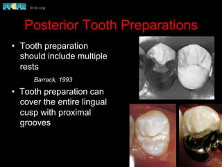 Posterior Tooth Preparations
•  Tooth preparation
should include multiple
rests
Barrack, 1993
• Tooth preparation can
cover the entire lingual
cusp with proximal
grooves
 