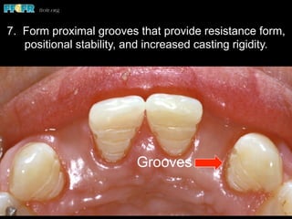 Grooves
7. Form proximal grooves that provide resistance form,
positional stability, and increased casting rigidity.
 