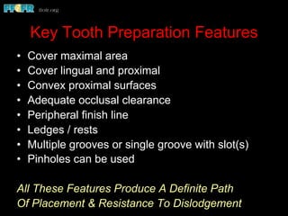 Key Tooth Preparation Features
•  Cover maximal area
•  Cover lingual and proximal
•  Convex proximal surfaces
•  Adequate occlusal clearance
•  Peripheral finish line
•  Ledges / rests
•  Multiple grooves or single groove with slot(s)
•  Pinholes can be used
All These Features Produce A Definite Path
Of Placement & Resistance To Dislodgement
 