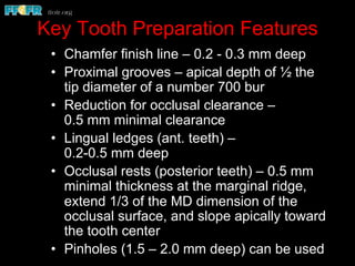 •  Chamfer finish line – 0.2 - 0.3 mm deep
•  Proximal grooves – apical depth of ½ the
tip diameter of a number 700 bur
•  Reduction for occlusal clearance –
0.5 mm minimal clearance
•  Lingual ledges (ant. teeth) –
0.2-0.5 mm deep
•  Occlusal rests (posterior teeth) – 0.5 mm
minimal thickness at the marginal ridge,
extend 1/3 of the MD dimension of the
occlusal surface, and slope apically toward
the tooth center
•  Pinholes (1.5 – 2.0 mm deep) can be used
Key Tooth Preparation Features
 
