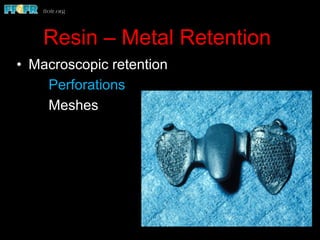 Resin – Metal Retention
•  Macroscopic retention
Perforations
Meshes
 
