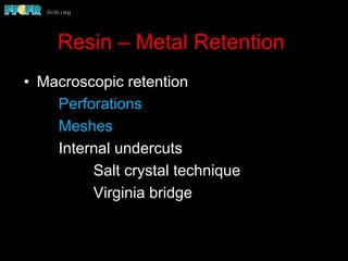 Resin – Metal Retention
•  Macroscopic retention
Perforations
Meshes
Internal undercuts
Salt crystal technique
Virginia bridge
 