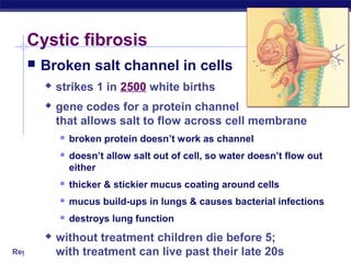 Regents Biology
Cystic fibrosis
 Broken salt channel in cells
 strikes 1 in 2500 white births
 gene codes for a protein channel
that allows salt to flow across cell membrane
 broken protein doesn’t work as channel
 doesn’t allow salt out of cell, so water doesn’t flow out
either
 thicker & stickier mucus coating around cells
 mucus build-ups in lungs & causes bacterial infections
 destroys lung function
 without treatment children die before 5;
with treatment can live past their late 20s
 
