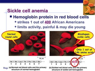 Regents Biology
Sickle cell anemia
 Hemoglobin protein in red blood cells
 strikes 1 out of 400 African Americans
 limits activity, painful & may die young
Normal
round cells
Misshapen
sickle cells
Only 1 out of
146 amino acids
 