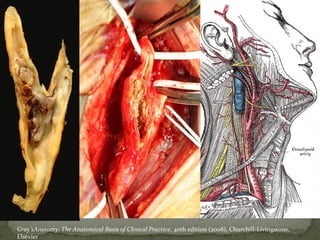 Gray’sAnatomy: The Anatomical Basis of Clinical Practice, 40th edition (2008), Churchill-Livingstone,
Elsevier
 