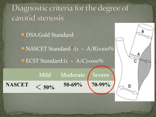 DSA:Gold Standard
NASCET Standard*:(1 － A/B)×100%
ECST Standard:(1 － A/C)×100%
Mild Moderate Severe
NASCET ＜ 50% 50-69% 70-99%
 