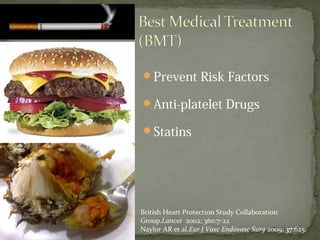 Prevent Risk Factors
Anti-platelet Drugs
Statins
British Heart Protection Study Collaboration
Group.Lancet 2002; 360:7-22
Naylor AR et al.Eur J Vasc Endovasc Surg 2009; 37:625.
 