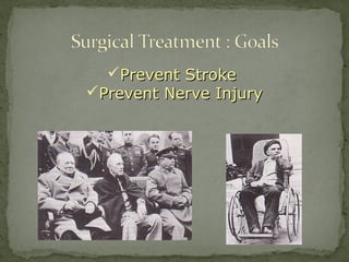 Prevent StrokePrevent Stroke
Prevent Nerve InjuryPrevent Nerve Injury
 
