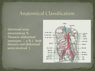  Infrarenal aorta
aneurysm:95 ％
 Thoracic-abdominal
aneurysm ： 5 ％（ both
thoracic and abdomianl
aorta involved ）
 