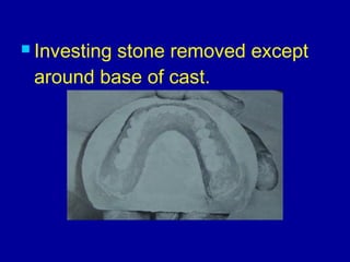  Investing stone removed except
around base of cast.
 