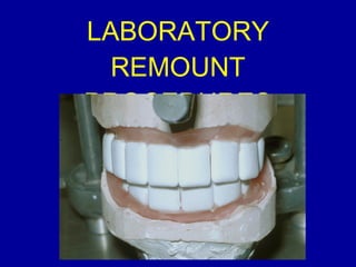 LABORATORY
REMOUNT
PROCEDURES
 