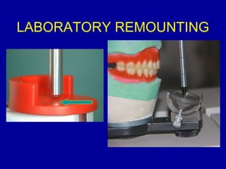 LABORATORY REMOUNTING
 