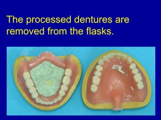 The processed dentures are
removed from the flasks.
 
