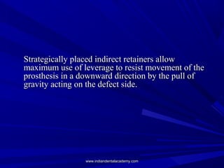 Strategically placed indirect retainers allowStrategically placed indirect retainers allow
maximum use of leverage to resi...