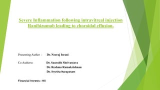 Severe Inflammation following intravitreal injection
Ranibizumab leading to choroidal effusion.
Presenting Author : Dr. Neeraj Israni
Co Authors: Dr. Saurabh Shrivastava
Dr. Reshma Ramakrishnan
Dr. Swetha Narayanam
Financial intrests : Nil
 