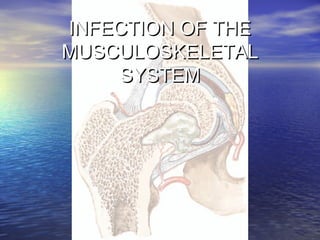 INFECTION OF THEINFECTION OF THE
MUSCULOSKELETALMUSCULOSKELETAL
SYSTEMSYSTEM
 