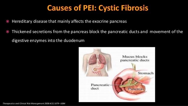 Basics of Pancreatitis and Pancreatic Exocrine Insufficiency Basics of Pancreatitis and Pancreatic Exocrine Insufficiency