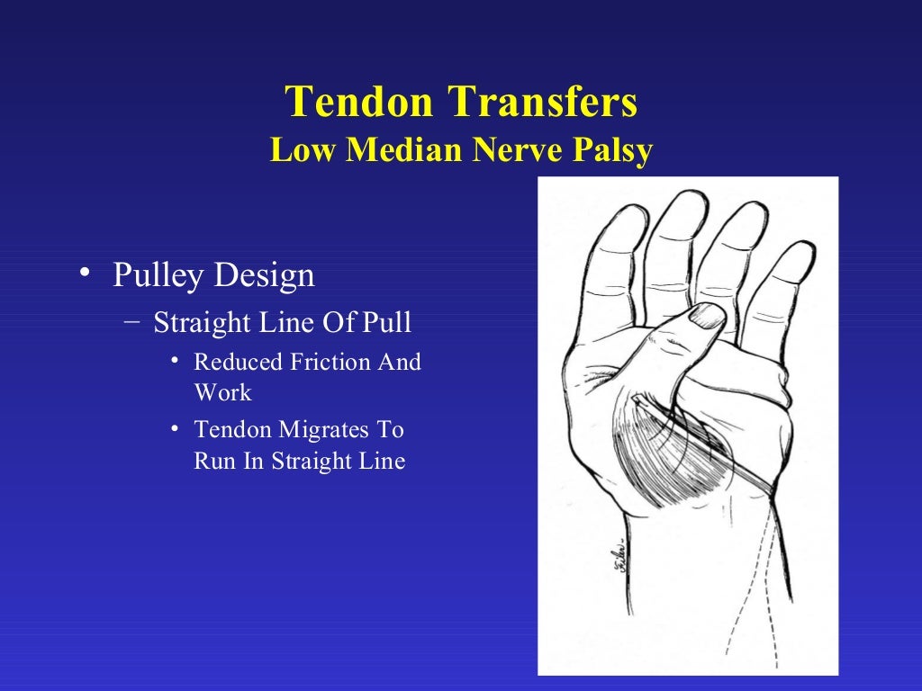 12. tendon transfers