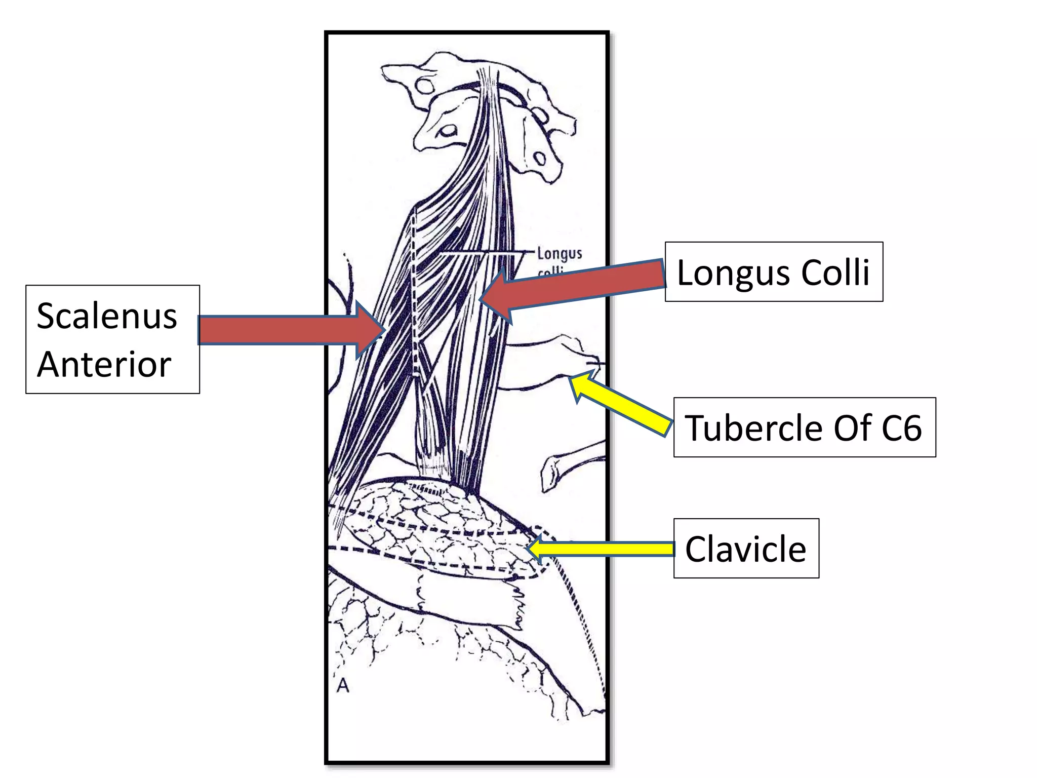 Longus Colli
Scalenus
Anterior
Tubercle Of C6
Clavicle
 