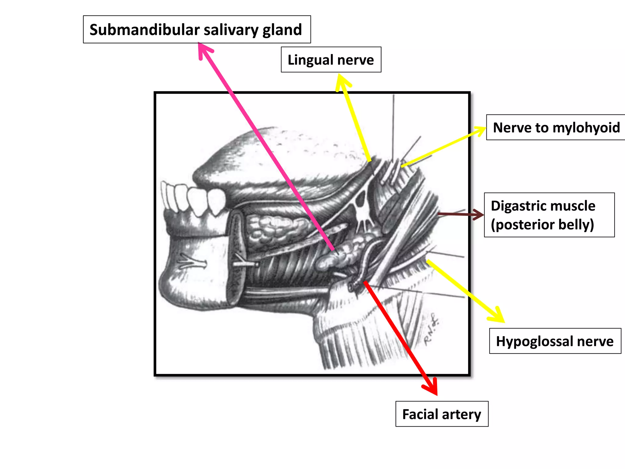 Submandibular salivary gland
Lingual nerve
Nerve to mylohyoid
Digastric muscle
(posterior belly)
Hypoglossal nerve
Facial artery
 