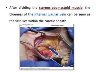 • After dividing the sternocledomastoid muscle, the
blueness of the internal jugular vein can be seen as
the vein lies within the carotid sheath.
 