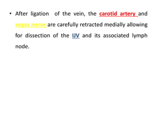 • After ligation of the vein, the carotid artery and
vegus nerve are carefully retracted medially allowing
for dissection of the IJV and its associated lymph
node.
 