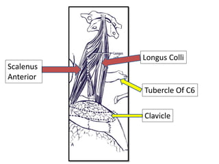 Longus Colli
Scalenus
Anterior
Tubercle Of C6
Clavicle
 