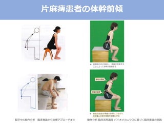片麻痺患者の体幹前傾
動作分析 臨床活用講座 バイオメカニクスに基づく臨床推論の実践脳卒中の動作分析 臨床推論から治療アプローチまで
 