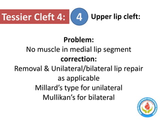 Craniofacial soft tissue reconstruction | PPT