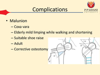 Complications
• Malunion
– Coxa vara
– Elderly mild limping while walking and shortening
– Suitable shoe raise
– Adult
– Corrective osteotomy
 