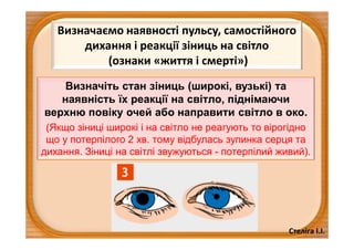 Стеліга І.І.
Визначаємо наявності пульсу, самостійного
дихання і реакції зіниць на світло
(ознаки «життя і смерті»)
Визначіть стан зіниць (широкі, вузькі) та
наявність їх реакції на світло, піднімаючи
верхню повіку очей або направити світло в око.
(Якщо зіниці широкі і на світло не реагують то вірогідно
що у потерпілого 2 хв. тому відбулась зупинка серця та
дихання. Зіниці на світлі звужуються - потерпілий живий).
 