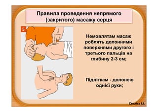 Стеліга І.І.
Правила проведення непрямого
(закритого) масажу серця
Немовлятам масаж
роблять долонними
поверхнями другого і
третього пальців на
глибину 2-3 см;
Підліткам - долонею
однієї руки;
 