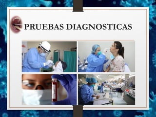 PRUEBAS DIAGNOSTICAS
 