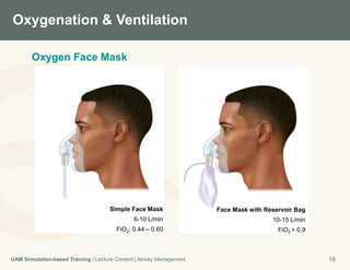 V Mask Fio2 Airway Management | PPTX