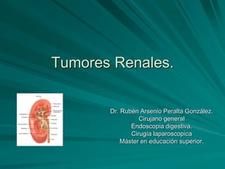 Tumores Renales.
Dr. Rubén Arsenio Peralta González.
Cirujano general
Endoscopia digestiva.
Cirugía laparoscopica
Máster en educación superior.
 