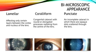 BI-MICROSCOPIC
APPEARANCE
Lamellar
Affecting only certain
layers between the cortex
and nucleus of the lens.
Coralliform
Congenital cataract with
round or elongated
processes radiating from
the centre of the lens.
Punctate
An incomplete cataract in
which there are opaque
dots scattered through
the lens.
 