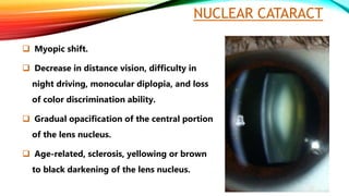 NUCLEAR CATARACT
 Myopic shift.
 Decrease in distance vision, difficulty in
night driving, monocular diplopia, and loss
of color discrimination ability.
 Gradual opacification of the central portion
of the lens nucleus.
 Age-related, sclerosis, yellowing or brown
to black darkening of the lens nucleus.
 