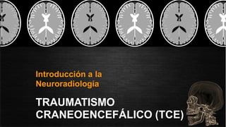 Introducción a la
Neuroradiología
TRAUMATISMO
CRANEOENCEFÁLICO (TCE)
 