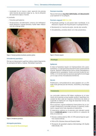 Tema 3 · Dermatosis eritematoescamosas
27
- Localizada (no en manos y pies): aparición de pústulas
sobre lesiones de psoriasis vulgar (p. ej., tras la utilización
de tratamiento tópico irritante).
• Localizada.
- Pustulosis palmoplantar.
- Acropustulosis (acrodermatitis continua de Hallopeau):
existe afectación ungueal llamativa. Puede haber reabsor-
ción de la falange distal.
Eritrodermia psoriásica
Piel roja con descamación superficial, afecta a todo el tegumento.
Se acompaña de fiebre y malestar. Mortalidad importante.
Artropatía psoriásica
(Ver manual de Reumatología)
Psoriasis invertida
Placas eritematosas muy bien delimitadas, sin descamación
y que aparecen en los pliegues.
Psoriasis ungueal (MIR 16, 214)
• Piqueteado (pitting): la uña parece latón martilleado. Es la
afectación ungueal más frecuente pero no patognomónica.
• Decoloración en mancha de aceite: uña de color amarillo.
• Onicodistrofia y onicólisis distal: es lo más característico.
Histología
Epidermis
Es típica la hiperplasia regular con hiperqueratosis orto y para-
queratósica. La capa granulosa está disminuida o prácticamente
ausente. Aparecen alargamientos de las crestas interpapilares y
adelgazamiento suprapapilar. Existen acúmulos focales de neu-
trófilos: en el estrato espinoso (pústula espongiforme de Kogoj)
y en la capa córnea (microabscesos de Munro).
Dermis
Proliferación y tortuosidad de los vasos papilares con un infil-
trado mixto perivascular de linfocitos, neutrófilos y macrófagos
(MIR).
Tratamiento
Los corticoides sistémicos NO deben emplearse en el trata-
miento de la psoriasis ya que pueden producir taquifilaxia (ne-
cesidad de dosis cada vez mayores) y fenómeno de rebote al
suspender la medicación con riesgo de desarrollar formas más
agresivas (pustulosas).
Para la psoriasis ungueal empleamos triamcinolona (es un cor-
ticoide) intralesional y corticoides oclusivos. En general, la afec-
tación ungueal tiene mala respuesta al tratamiento.
El tratamiento sistémico en la psoriasis está indicado cuando
ésta es moderada-grave, lo que se define en cualquiera de
estas circunstancias:
• Psoriasis cutánea extensa: BSA >5-10% (porcentaje de super-
ficie corporal afecta).
• PASI ≥10% (Psoriasis Area and Severity Index).
• Percepción de gravedad subjetiva (Dermatology Life Quality
Index [DLQI] >10).
Figura 3. Psoriasis pustulosa localizada: pustulosis palmar.
Figura 4. Eritrodermia psoriásica.
Figura 5. Psoriasis ungueal.
 