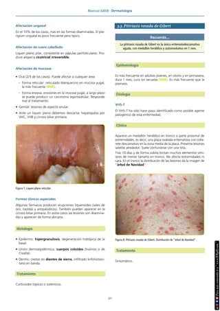 Manual AMIR · Dermatología
30
Afectación ungueal
En el 10% de los casos, más en las formas diseminadas. El pte-
rigium ungueal es poco frecuente pero típico.
Afectación de cuero cabelludo
Liquen plano pilar, consistente en pápulas perifoliculares. Pro-
duce alopecia cicatricial irreversible.
Afectación de mucosas
• Oral (2/3 de los casos). Puede afectar a cualquier área:
- Forma reticular: reticulado blanquecino en mucosa yugal,
la más frecuente (MIR).
- Forma erosiva: erosiones en la mucosa yugal, a largo plazo
se puede producir un carcinoma espinocelular. Responde
mal al tratamiento.
• Genital: lesiones de aspecto anular.
• Ante un liquen plano debemos descartar hepatopatía por
VHC, VHB y cirrosis biliar primaria.
Formas clínicas especiales
Algunos fármacos producen erupciones liquenoides (sales de
oro, tiazidas y antipalúdicos). También pueden aparecer en la
cirrosis biliar primaria. En estos casos las lesiones son disemina-
das y aparecen de forma abrupta.
Histología
• Epidermis: hipergranulosis, degeneración hidrópica de la
basal.
• Unión dermoepidérmica: cuerpos coloides (hialinos o de
Civatte).
• Dermis: crestas en dientes de sierra, infiltrado linfohistioci-
tario en banda.
Tratamiento
Corticoides tópicos o sistémicos.
3.3. Pitiriasis rosada de Gibert
Epidemiología
Es más frecuente en adultos jóvenes, en otoño y en primavera,
dura 1 mes, cura sin secuelas (MIR). Es más frecuente que la
psoriasis.
Etiología
VHS-7
El VHS-7 ha sido hace poco identificado como posible agente
patogénico de esta enfermedad.
Clínica
Aparece un medallón heráldico en tronco o parte proximal de
extremidades, es decir, una placa ovalada eritematosa con colla-
rete descamativo en la zona media de la placa. Presenta lesiones
satélite alrededor. Suele confundirse con una tiña.
Tras 10 días y de forma súbita brotan muchos elementos simi-
lares de menor tamaño en tronco. No afecta extremidades ni
cara. En el tronco la distribución de las lesiones da la imagen de
“árbol de Navidad”.
Tratamiento
Sintomático.
Figura 7. Liquen plano reticular.
Recuerda...
La pitiriasis rosada de Gibert es la única eritematodescamativa
aguda, con medallón heráldico y autoinvolutiva en 1 mes.
Figura 8. Pitiriasis rosada de Gibert. Distribución de “árbol de Navidad”.
 