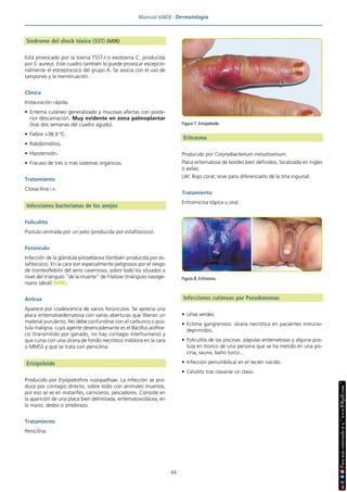 Manual AMIR · Dermatología
44
Síndrome del shock tóxico (SST) (MIR)
Está provocado por la toxina TSST-I o exotoxina C, producida
por S. aureus. Este cuadro también lo puede provocar excepcio-
nalmente el estreptococo del grupo A. Se asocia con el uso de
tampones y la menstruación.
Clínica
Instauración rápida.
• Eritema cutáneo generalizado y mucosas afectas con poste-
rior descamación. Muy evidente en zona palmoplantar
(tras dos semanas del cuadro agudo).
• Fiebre >38,9 ºC.
• Rabdomiólisis.
• Hipotensión.
• Fracaso de tres o más sistemas orgánicos.
Tratamiento
Cloxacilina i.v.
Infecciones bacterianas de los anejos
Foliculitis
Pústula centrada por un pelo (producida por estafilococo).
Forúnculo
Infección de la glándula pilosebácea (también producida por es-
tafilococo). En la cara son especialmente peligrosos por el riesgo
de tromboflebitis del seno cavernoso, sobre todo los situados a
nivel del triángulo “de la muerte” de Filatow (triángulo nasoge-
niano labial) (MIR).
Ántrax
Aparece por coalescencia de varios forúnculos. Se aprecia una
placa eritematoedematosa con varias aberturas que liberan un
material purulento. No debe confundirse con el carbunco o pús-
tula maligna, cuyo agente desencadenante es el Bacillus anthra-
cis (transmitido por ganado, no hay contagio interhumano) y
que cursa con una úlcera de fondo necrótico indolora en la cara
o MMSS y que se trata con penicilina.
Erisipeloide
Producido por Erysipelothrix rusiopathiae. La infección se pro-
duce por contagio directo, sobre todo con animales muertos,
por eso se ve en matarifes, carniceros, pescadores. Consiste en
la aparición de una placa bien delimitada, eritematoviolácea, en
la mano, dedos o antebrazo.
Tratamiento
Penicilina.
Eritrasma
Producido por Corynebacterium minutissimum.
Placa eritematosa de bordes bien definidos, localizada en ingles
o axilas.
LW: Rojo coral; sirve para diferenciarlo de la tiña inguinal.
Tratamiento
Eritromicina tópica u oral.
Infecciones cutáneas por Pseudomonas
• Uñas verdes.
• Ectima gangrenoso: úlcera necrótica en pacientes inmuno-
deprimidos.
• Foliculitis de las piscinas: pápulas eritematosas y alguna pús-
tula en tronco de una persona que se ha metido en una pis-
cina, sauna, baño turco...
• Infección periumbilical en el recién nacido.
• Celulitis tras clavarse un clavo.
Figura 7. Erisipeloide.
Figura 8. Eritrasma.
 