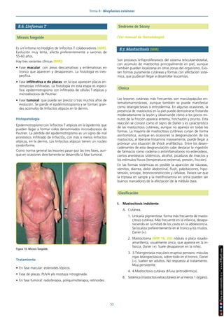 Tema 8 · Neoplasias cutáneas
53
8.6. Linfomas T
Micosis fungoide
Es un linfoma no Hodgkin de linfocitos T colaboradores (MIR).
Evolución muy lenta, afecta preferentemente a varones de
55-60 años.
Hay tres variantes clínicas (MIR):
• Fase macular: con áreas descamativas y eritematosas en
tronco que aparecen y desaparecen. La histología es ines-
pecífica.
• Fase infiltrativa o de placas: en la que aparecen placas eri-
tematosas infiltradas. La histología en esta etapa es especí-
fica: epidermotropismo con infiltrados de células T atípicas y
microabscesos de Pautrier.
• Fase tumoral: que puede ser precoz o tras muchos años de
evolución. Se pierde el epidermotropismo y se forman gran-
des acúmulos de linfocitos atípicos en la dermis.
Histopatología
Epidermotropismo con linfocitos T atípicos en la epidermis que
pueden llegar a formar nidos denominados microabscesos de
Pautrier. La pérdida del epidermotropismo es un signo de mal
pronóstico. Infiltrado de linfocitos, con más o menos linfocitos
atípicos, en la dermis. Los linfocitos atípicos tienen un núcleo
cerebriforme.
Como norma general las lesiones pasan por las tres fases, aun-
que en ocasiones directamente se desarrolla la fase tumoral.
Tratamiento
• En fase macular: esteroides tópicos.
• Fase de placas: PUVA y/o mostaza nitrogenada.
• En fase tumoral: radioterapia, poliquimioterapia, retinoides.
Síndrome de Sézary
(Ver manual de Hematología)
8.7. Mastocitosis (MIR)
Son procesos linfoproliferativos del sistema reticuloendotelial,
con acúmulo de mastocitos principalmente en piel, aunque
también pueden localizarse en otras zonas del organismo. Exis-
ten formas puramente cutáneas y formas con afectación sisté-
mica, que pudieran llegar a desarrollar leucemias.
Clínica
Las lesiones cutáneas más frecuentes son maculopápulas eri-
tematomarronáceas, aunque también se puede manifestar
como telangiectasias o eritrodermia. En algunas ocasiones, la
presencia de mastocitos en la piel puede demostrarse frotando
moderadamente la lesión y observando cómo a los pocos mi-
nutos de la fricción aparece eritema, hinchazón y prurito. Esta
reacción se conoce como el signo de Darier y es característico
de las mastocitosis cutáneas, aunque no aparece en todas las
formas. La mayoría de mastocitosis cutáneas cursan de forma
asintomática, aunque en ocasiones la desgranulación de los
mastocitos, al liberarse histamina masivamente, puede llegar a
provocar una situación de shock anafiláctico. Entre los desen-
cadenantes de esta desgranulación cabe destacar la ingestión
de fármacos como codeína o antiinflamatorios no esteroideos,
ciertos anestésicos sistémicos, alcohol, picaduras de insectos y
los estímulos físicos (temperaturas extremas, presión, fricción).
En las formas sistémicas es posible la aparición de náuseas,
vómitos, diarrea, dolor abdominal, flush, palpitaciones, hipo-
tensión, síncope, broncoconstricción y cefaleas. Parece ser que
la triptasa en sangre y la metilhistamina en orina pueden ser
buenos marcadores de la afectación de la médula ósea.
Clasificación
I. Mastocitosis indolente.
A. Cutánea.
1. Urticaria pigmentosa: forma más frecuente de masto-
citosis cutánea. Más frecuente en la infancia, desapa-
reciendo en la mitad de los casos en la adolescencia.
Se localiza preferentemente en el tronco y los muslos.
Darier (+).
2. Mastocitoma (MIR 18, 20): nódulo o placa rosado-
amarillenta, usualmente única, que aparece en la in-
fancia. Darier (+). Suele desaparecer en la niñez.
3. 3.Telangiectasia macularis eruptiva perstans: máculas
rojas telangiectásicas, sobre todo en el tronco. Darier
(−). Suelen ser adultos. No respuesta al tratamiento.
Muy persistente.
4. 4.Mastocitosis cutánea difusa (eritrodérmica).
B. Sistémica (mastocitos extracutáneos en al menos 1 órgano).
Figura 10. Micosis fungoide.
 