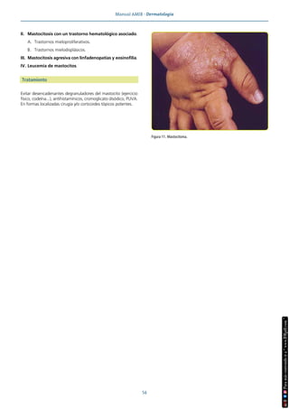 Manual AMIR · Dermatología
54
II. Mastocitosis con un trastorno hematológico asociado.
A. Trastornos mieloproliferativos.
B. Trastornos mielodisplásicos.
III. Mastocitosis agresiva con linfadenopatías y eosinofilia.
IV. Leucemia de mastocitos.
Tratamiento
Evitar desencadenantes degranuladores del mastocito (ejercicio
físico, codeína...), antihistamínicos, cromoglicato disódico, PUVA.
En formas localizadas cirugía y/o corticoides tópicos potentes.
Figura 11. Mastocitoma.
 