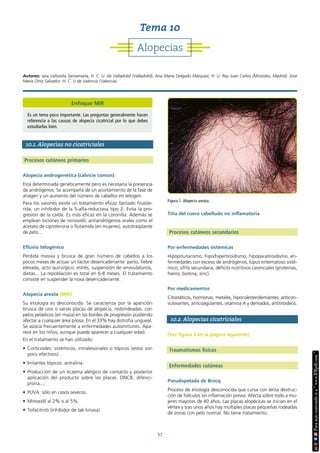 57
10.1. Alopecias no cicatriciales
Procesos cutáneos primarios
Alopecia androgenética (calvicie común)
Está determinada genéticamente pero es necesaria la presencia
de andrógenos. Se acompaña de un acortamiento de la fase de
anagen y un aumento del número de cabellos en telogen.
Para los varones existe un tratamiento eficaz llamado finaste-
rida, un inhibidor de la 5-alfa-reductasa tipo 2. Evita la pro-
gresión de la caída. Es más eficaz en la coronilla. Además se
emplean lociones de minoxidil, antiandrógenos orales como el
acetato de ciproterona o flutamida (en mujeres), autotrasplante
de pelo...
Efluvio telogénico
Pérdida masiva y brusca de gran número de cabellos a los
pocos meses de actuar un factor desencadenante: parto, fiebre
elevada, acto quirúrgico, estrés, suspensión de anovulatorios,
dietas... La repoblación es total en 6-8 meses. El tratamiento
consiste en suspender la noxa desencadenante.
Alopecia areata (MIR)
Su etiología es desconocida. Se caracteriza por la aparición
brusca de una o varias placas de alopecia, redondeadas, con
pelos peládicos (en maza) en los bordes de progresión pudiendo
afectar a cualquier área pilosa. En el 33% hay distrofia ungueal.
Se asocia frecuentemente a enfermedades autoinmunes. Apa-
rece en los niños, aunque puede aparecer a cualquier edad.
En el tratamiento se han utilizado:
• Corticoides: sistémicos, intralesionales o tópicos (estos son
poco efectivos).
• Irritantes tópicos: antralina.
• Producción de un eczema alérgico de contacto y posterior
aplicación del producto sobre las placas: DNCB, difenci-
prona,...
• PUVA: sólo en casos severos.
• Minoxidil al 2% o al 5%.
• Tofacitinib (inhibidor de Jak kinasa).
Tiña del cuero cabelludo no inflamatoria
Procesos cutáneos secundarios
Por enfermedades sistémicas
Hipopituitarismo, hipo/hipertiroidismo, hipoparatiroidismo, en-
fermedades con exceso de andrógenos, lupus eritematoso sisté-
mico, sífilis secundaria, déficits nutritivos carenciales (proteínas,
hierro, biotina, zinc).
Por medicamentos
Citostáticos, hormonas, metales, hipocolesterolemiantes, anticon-
vulsivantes, anticoagulantes, vitamina A y derivados, antitiroideos.
10.2. Alopecias cicatriciales
(Ver figura 2 en la página siguiente)
Traumatismos físicos
Enfermedades cutáneas
Pseudopelada de Brocq
Proceso de etiología desconocida que cursa con lenta destruc-
ción de folículos sin inflamación previa. Afecta sobre todo a mu-
jeres mayores de 40 años. Las placas alopécicas se inician en el
vértex y tras unos años hay múltiples placas pequeñas rodeadas
de zonas con pelo normal. No tiene tratamiento.
Figura 1. Alopecia areata.
Alopecias
Tema 10
Autores: Jara Valtueña Santamaría, H. C. U. de Valladolid (Valladolid). Ana María Delgado Márquez, H. U. Rey Juan Carlos (Móstoles, Madrid). José
María Ortiz Salvador, H. C. U de Valencia (Valencia).
Enfoque MIR
Es un tema poco importante. Las preguntas generalmente hacen
referencia a las causas de alopecia cicatricial por lo que debes
estudiarlas bien.
 