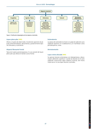 Manual AMIR · Dermatología
58
Liquen plano pilar (MIR)
Afecta a mujeres de edad media. Inicialmente aparición de pá-
pulas eritematovioláceas, descamativas y posteriormente tapo-
nes foliculares y cicatrización.
Alopecia fibrosante frontal
Típica de mujeres posmenopaúsicas. Es una variante de liquen
plano pilar que afecta en banda la zona frontal.
Esclerodermia
Las placas de esclerodermia lineal o en golpe de sable del cuero
cabelludo aparecen en la adolescencia y se manifiestan como
piel blanquecina, cérea.
Dermatomiositis
Lupus crónico discoide (MIR)
Se aprecian lesiones eritematosas con telangiectasias y desca-
mación adherente superficial. Cuando las lesiones en el cuero
cabelludo involucionan dejan alopecia cicatrizal, del mismo
modo que en la cara dejan lesiones cicatrizales.
Figura 2. Clasificación etiopatogénica de las alopecias cicatriciales.
Alopecia cicatricial
Dermatosis
inflamatorias
Tumoral
Infecciones
Agentes físicos
Congénitas
Piodermitis
Micobacterias
(lupus vulgar,
lepra lepromatosa)
Herpes zóster
Tiñas inflamatorias
Morfea
Liquen plano
Lupus discoide
Sarcoidosis
Dermatomiositis
Foliculitis
decalvante
Foliculitis disecante
Traumatismos
Quemaduras
Radiaciones
ionizantes
Aplasia cutis
Nevo sebáceo
 