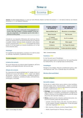 59
Consiste en una respuesta inflamatoria de la piel que clínica-
mente se caracteriza por una serie de lesiones que se combinan
o suceden: eritema, vesícula, erosión, exudación, costra, desca-
mación y liquenificación (MIR 10, 21). Se acompaña de intenso
prurito. En la fase aguda son lesiones exudativas y en la fase
crónica lesiones secas.
Histología
En la epidermis hay espongiosis y acantosis. En la dermis existe
un infiltrado inflamatorio, usualmente linfocitario.
Eccema exógeno
Irritativo de contacto
Por acción directa de una sustancia sobre la epidermis, de forma
repetida y prolongada (del pañal, del ama de casa).
Alérgico de contacto
Por mecanismo de hipersensibilidad tipo IV: metales (cromo –el
cemento es la causa más habitual (MIR)–, níquel –por objetos
de bisutería–, mercurio –en empastes y antisépticos tópicos–),
antibióticos, antisépticos, anestésicos locales, antihistamínicos,
antifúngicos, corticoides.
Fototóxico (MIR)
Es más frecuente que el fotoalérgico.
Además del agente externo interviene la luz. Son causa frecuente
los medicamentos. Son un ejemplo típico las tetraciclinas.
Fotoalérgico
Patogenia inmunológica. Requiere sensibilización previa y ade-
más exposición solar. Son un ejemplo típico las sulfamidas.
Micótico (Dermatofítides)
Eccema endógeno
Dermatitis atópica
Se trata de un cuadro crónico que se asocia a otras manifesta-
ciones de atopia: asma, rinoconjuntivitis,... Existe un aumento
de la IgE. El diagnóstico es clínico y habitualmente no precisa de
pruebas complementarias (MIR 17, 30).
• Etiología: herencia poligénica, factores inmunológicos (IgE,
IgG4, linfocitos T circulantes y sensibilización a antígenos en
el 80%) y factores no inmunológicos (disminución del umbral
de prurito, de la secreción sebácea,...).
• Clínica: aparece prurito y lesiones cutáneas de eccema, ero-
siones de rascado y placas de liquenificación.
- Lactante: entre dos meses y dos años. El eccema afecta a
la cara (respeta triángulo nasogeniano). El área del pañal
suele estar respetada (MIR 10, 22).
- Niño: lesiones en flexuras, eccema y liquenificación (MIR).
- Adulto: liquenificación en flexuras, manos y pies.
Figura 1. Eccema alérgico de contacto.
Tabla 1. Eccema de contacto.
ECCEMA ALÉRGICO
DE CONTACTO
ECCEMA IRRITATIVO
DE CONTACTO
Hipersensibilidad tipo IV Mecanismo no inmunológico
Menos frecuente Más frecuente
2.º contacto
(necesita 1.er contacto)
En el 1.er contacto
Más agudo Menos agudo
A distancia En el lugar del contacto
Pruebas epicutáneas positivas Pruebas epicutáneas negativas
Eccema
Tema 11
Autores: Ana María Delgado Márquez, H. U. Rey Juan Carlos (Móstoles, Madrid). José María Ortiz Salvador, H. C. U de Valencia (Valencia). Jara Valtueña
Santamaría, H. C. U. de Valladolid (Valladolid).
Enfoque MIR
De los temas que vienen a continuación el más preguntado es el
eccema, sobre todo el atópico, y conviene estudiarlo. El resto son
muy poco preguntados y te aconsejamos que los mires sólo si
dominas los temas previos.
 