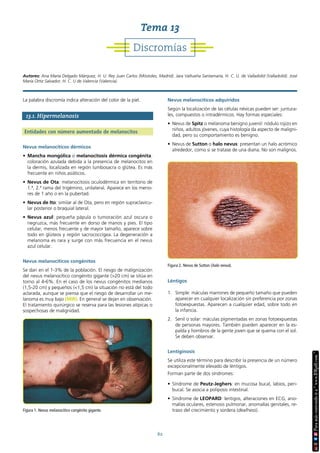 62
La palabra discromía indica alteración del color de la piel.
13.1. Hipermelanosis
Entidades con número aumentado de melanocitos
Nevus melanocíticos dérmicos
• Mancha mongólica o melanocitosis dérmica congénita:
coloración azulada debida a la presencia de melanocitos en
la dermis, localizada en región lumbosacra o glútea. Es más
frecuente en niños asiáticos.
• Nevus de Ota: melanocitosis oculodérmica en territorio de
1.ª, 2.ª rama del trigémino, unilateral. Aparece en los meno-
res de 1 año o en la pubertad.
• Nevus de Ito: similar al de Ota, pero en región supraclavicu-
lar posterior o braquial lateral.
• Nevus azul: pequeña pápula o tumoración azul oscura o
negruzca, más frecuente en dorso de manos y pies. El tipo
celular, menos frecuente y de mayor tamaño, aparece sobre
todo en glúteos y región sacrococcígea. La degeneración a
melanoma es rara y surge con más frecuencia en el nevus
azul celular.
Nevus melanocíticos congénitos
Se dan en el 1-3% de la población. El riesgo de malignización
del nevus melanocítico congénito gigante (>20 cm) se sitúa en
torno al 4-6%. En el caso de los nevus congénitos medianos
(1,5-20 cm) y pequeños (<1,5 cm) la situación no está del todo
aclarada, aunque se piensa que el riesgo de desarrollar un me-
lanoma es muy bajo (MIR). En general se dejan en observación.
El tratamiento quirúrgico se reserva para las lesiones atípicas o
sospechosas de malignidad.
Nevus melanocíticos adquiridos
Según la localización de las células névicas pueden ser: juntura-
les, compuestos o intradérmicos. Hay formas especiales:
• Nevus de Spitz o melanoma benigno juvenil: nódulo rojizo en
niños, adultos jóvenes, cuya histología da aspecto de maligni-
dad, pero su comportamiento es benigno.
• Nevus de Sutton o halo nevus: presentan un halo acrómico
alrededor, como si se tratase de una diana. No son malignos.
Léntigos
1. Simple: máculas marrones de pequeño tamaño que pueden
aparecer en cualquier localización sin preferencia por zonas
fotoexpuestas. Aparecen a cualquier edad, sobre todo en
la infancia.
2. Senil o solar: máculas pigmentadas en zonas fotoexpuestas
de personas mayores. También pueden aparecer en la es-
palda y hombros de la gente joven que se quema con el sol.
Se deben observar.
Lentiginosis
Se utiliza este término para describir la presencia de un número
excepcionalmente elevado de léntigos.
Forman parte de dos síndromes:
• Síndrome de Peutz-Jeghers: en mucosa bucal, labios, peri-
bucal. Se asocia a poliposis intestinal.
• Síndrome de LEOPARD: lentigos, alteraciones en ECG, ano-
malías oculares, estenosis pulmonar, anomalías genitales, re-
traso del crecimiento y sordera (deafness).
Figura 1. Nevus melanocítico congénito gigante.
Figura 2. Nevus de Sutton (halo nevus).
Discromías
Tema 13
Autores: Ana María Delgado Márquez, H. U. Rey Juan Carlos (Móstoles, Madrid). Jara Valtueña Santamaría, H. C. U. de Valladolid (Valladolid). José
María Ortiz Salvador, H. C. U de Valencia (Valencia).
 