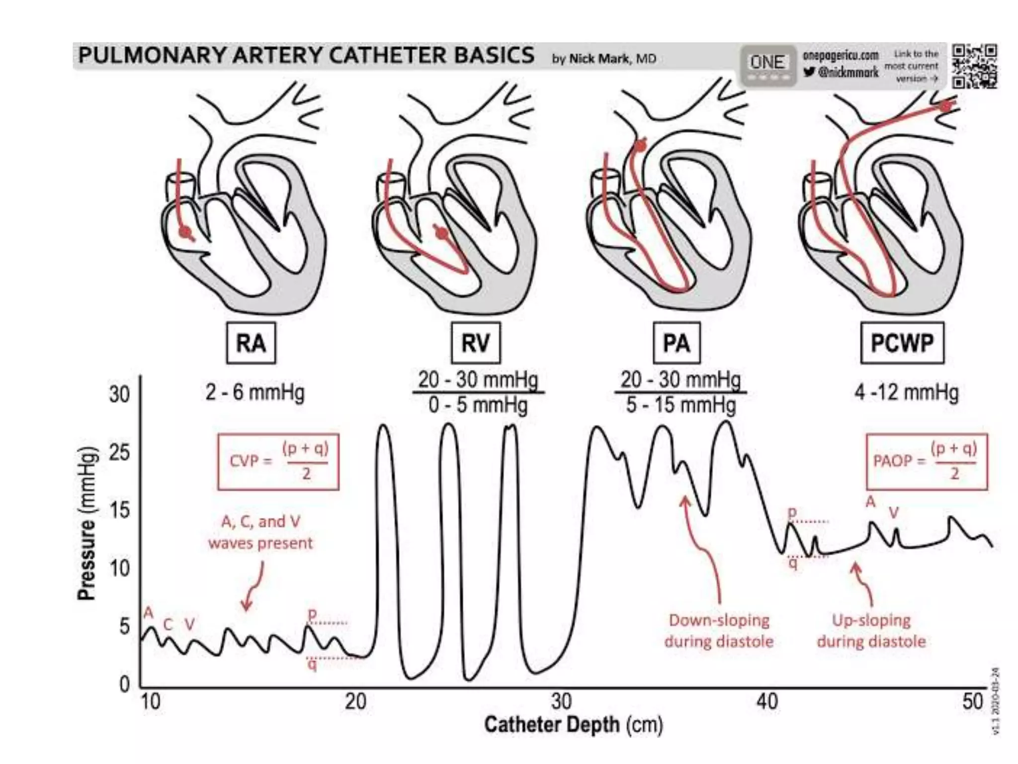 12-right-heart-catheterization-pros-cons-calculations-ppt