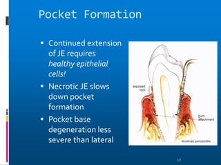 Pocket Formation
 Continued extension
of JE requires
healthy epithelial
cells!
 Necrotic JE slows
down pocket
formation
 Pocket base
degeneration less
severe than lateral
15
 